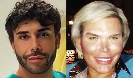 Giacomo Urtis E L Ex Fidanzato Rodrigo Alves Il Ken Umano Che Ha Cambiato Sesso