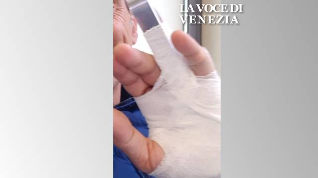 Occupazione Università Torino: lancio di uova e violenza. Poliziotti in ospedale